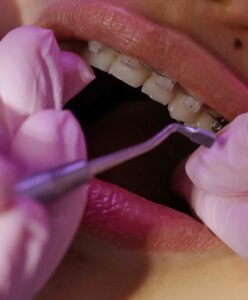 Estudiar Máster en Higienista Dental